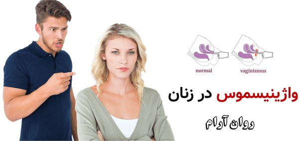 واژینیسموس در زنان؛ اختلال پنهان اما درمان‌پذیر